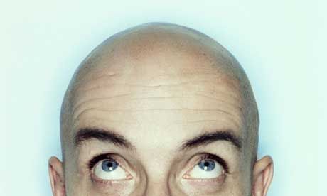 bald-head_zps2cfeefc2.jpg