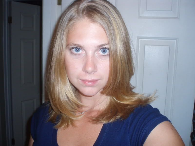 hair photo:treatment for hair loss 