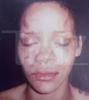 rihanna-bruise-picture.jpg